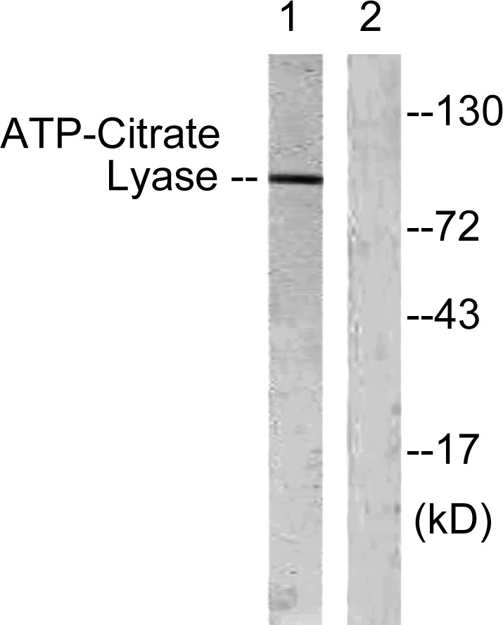 ATP-citrate synthase Rabbit Polyclonal Antibody | 兔多抗 | EnkiLife恩玑生命