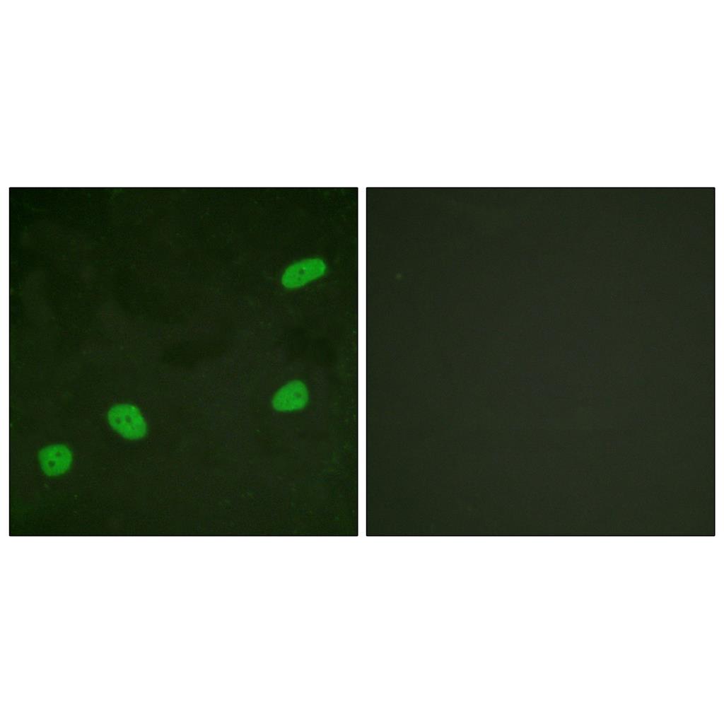 ATRIP Rabbit Polyclonal Antibody | 兔多抗 | EnkiLife恩玑生命