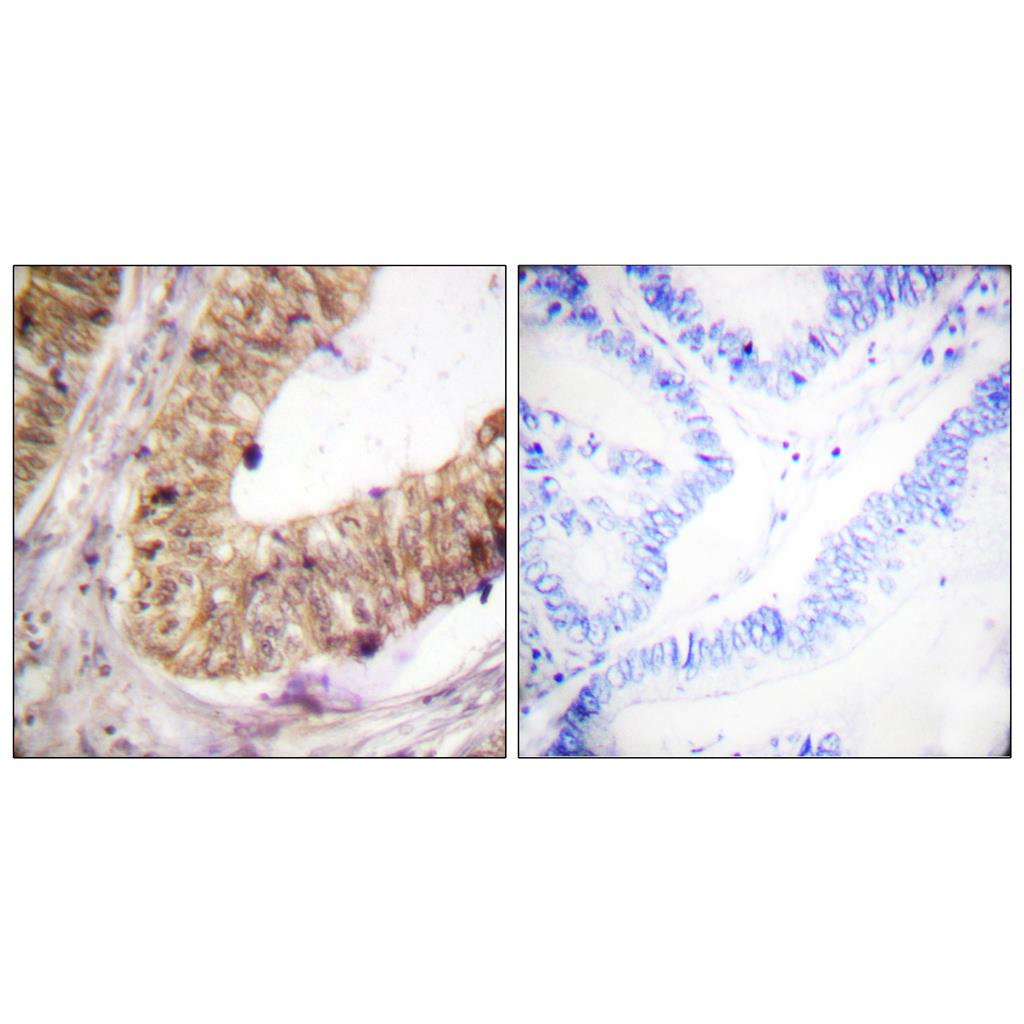 ATRIP Rabbit Polyclonal Antibody | 兔多抗 | EnkiLife恩玑生命