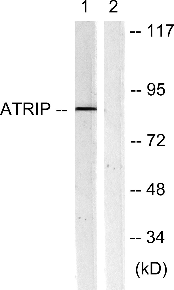 ATRIP Rabbit Polyclonal Antibody | 兔多抗 | EnkiLife恩玑生命