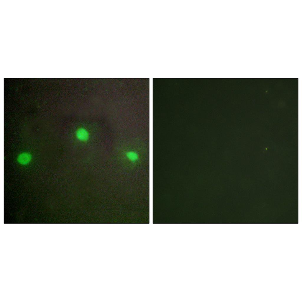 ATRX Rabbit Polyclonal Antibody | 兔多抗 | EnkiLife恩玑生命