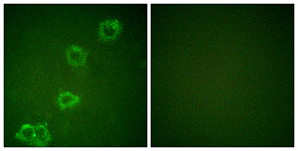 BACE Rabbit Polyclonal Antibody | 兔多抗 | EnkiLife恩玑生命