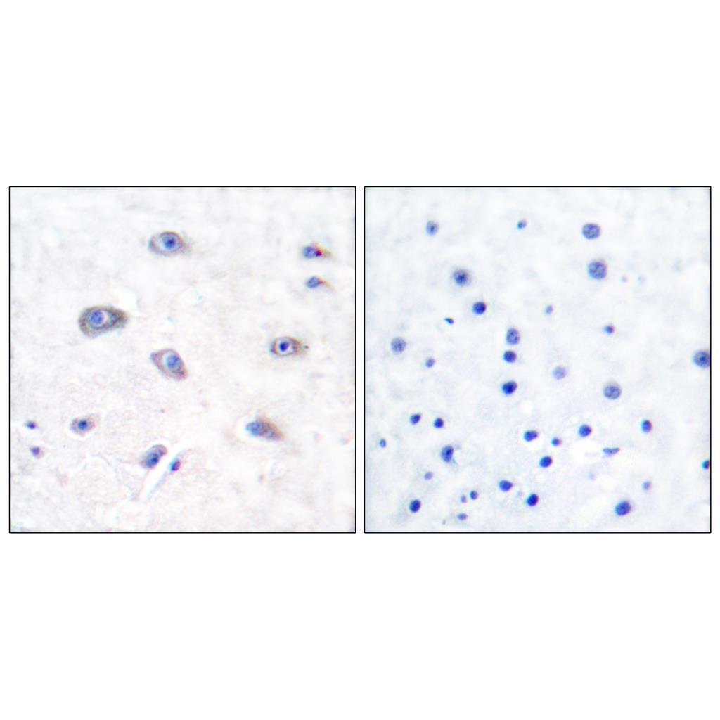 BACE Rabbit Polyclonal Antibody | 兔多抗 | EnkiLife恩玑生命