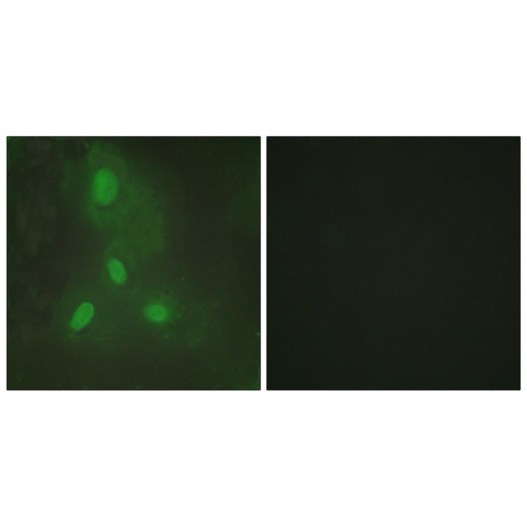 BACH1 Rabbit Polyclonal Antibody | 兔多抗 | EnkiLife恩玑生命