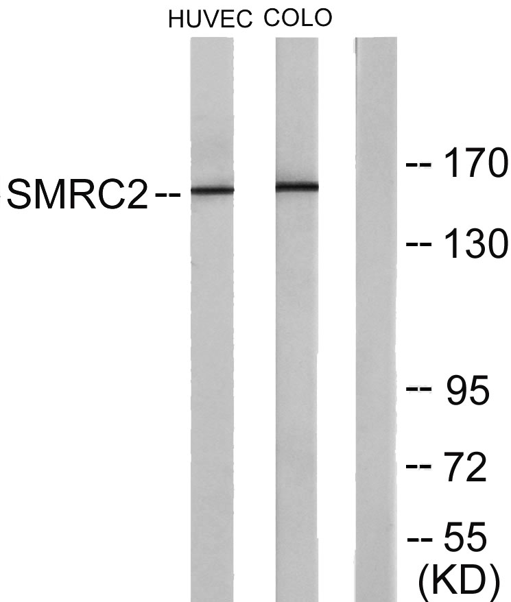 BAF170 Rabbit Polyclonal Antibody | 兔多抗 | EnkiLife恩玑生命