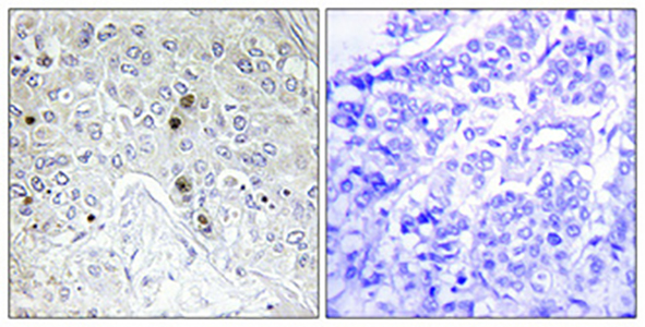 B-ATF Rabbit Polyclonal Antibody | 兔多抗 | EnkiLife恩玑生命