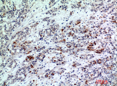 BATF3 Rabbit Polyclonal Antibody | 兔多抗 | EnkiLife恩玑生命