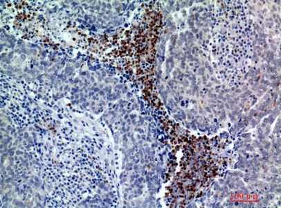 BATF3 Rabbit Polyclonal Antibody | 兔多抗 | EnkiLife恩玑生命