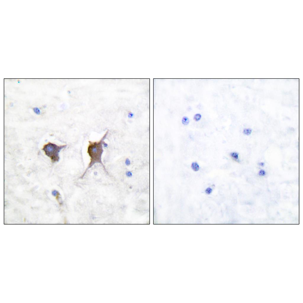 Bax Rabbit Polyclonal Antibody | 兔多抗 | EnkiLife恩玑生命