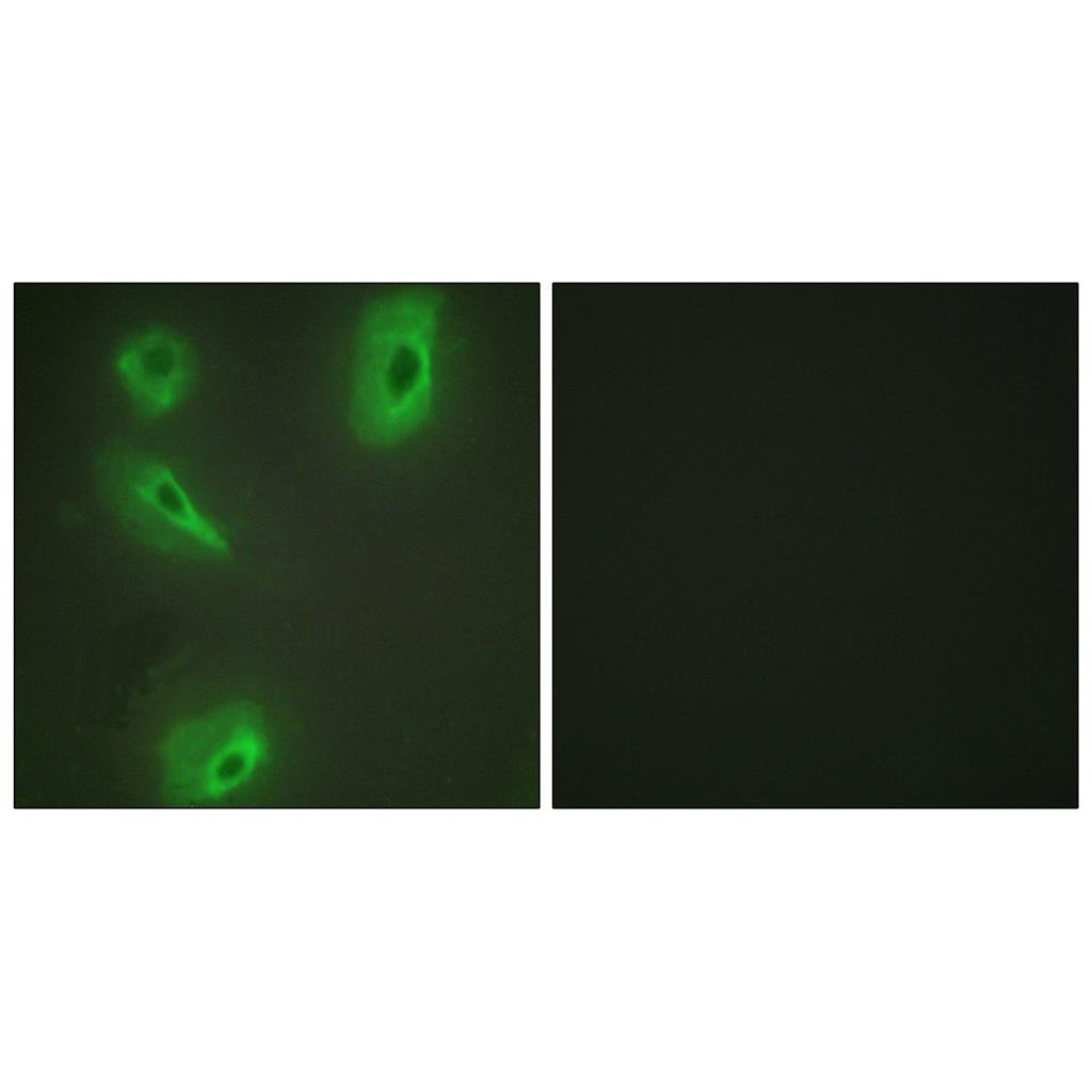 BCKDK Rabbit Polyclonal Antibody | 兔多抗 | EnkiLife恩玑生命