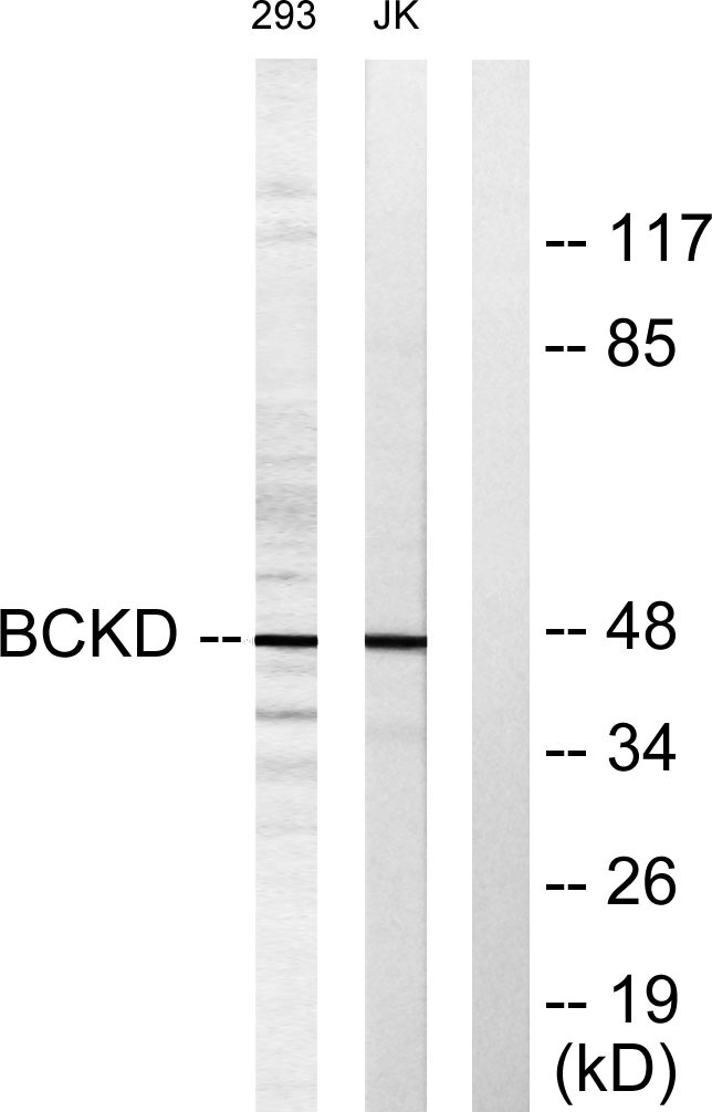 BCKDK Rabbit Polyclonal Antibody | 兔多抗 | EnkiLife恩玑生命