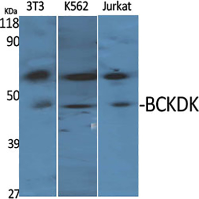 BCKDK Rabbit Polyclonal Antibody | 兔多抗 | EnkiLife恩玑生命