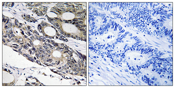 Bcl-10 Rabbit Polyclonal Antibody | 兔多抗 | EnkiLife恩玑生命