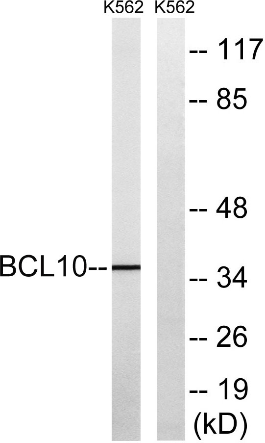 Bcl-10 Rabbit Polyclonal Antibody | 兔多抗 | EnkiLife恩玑生命