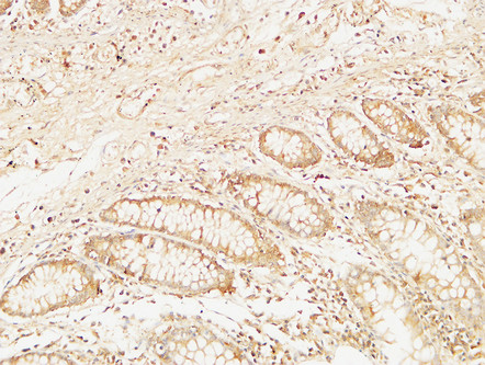 Bcl-10 Rabbit Polyclonal Antibody | 兔多抗 | EnkiLife恩玑生命