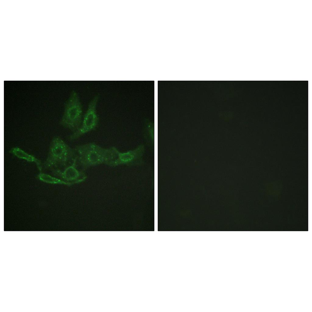 Bcl-2 Rabbit Polyclonal Antibody | 兔多抗 | EnkiLife恩玑生命