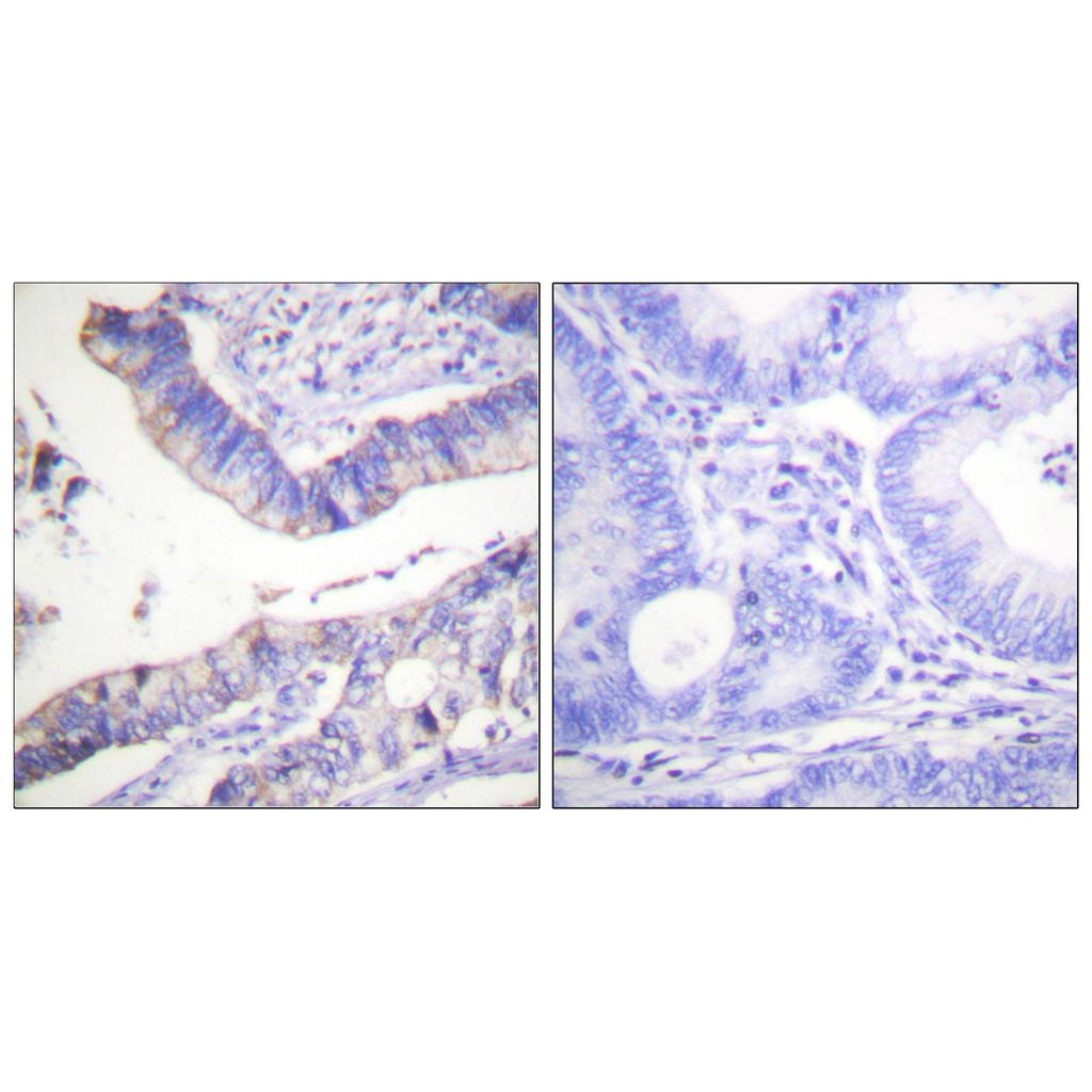 Bcl-2 Rabbit Polyclonal Antibody | 兔多抗 | EnkiLife恩玑生命