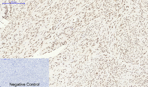 Bcl-6 Rabbit Polyclonal Antibody | 兔多抗 | EnkiLife恩玑生命