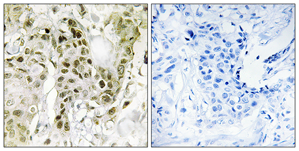 BCoR Rabbit Polyclonal Antibody | 兔多抗 | EnkiLife恩玑生命