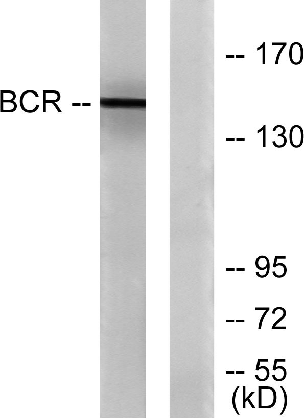 Bcr Rabbit Polyclonal Antibody | 兔多抗 | EnkiLife恩玑生命