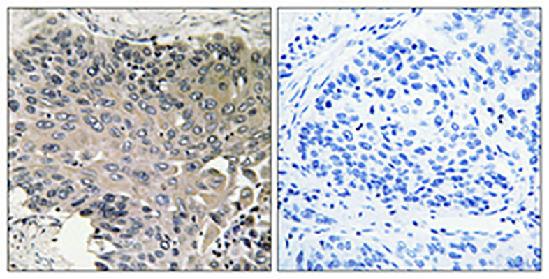 Bcr Rabbit Polyclonal Antibody | 兔多抗 | EnkiLife恩玑生命