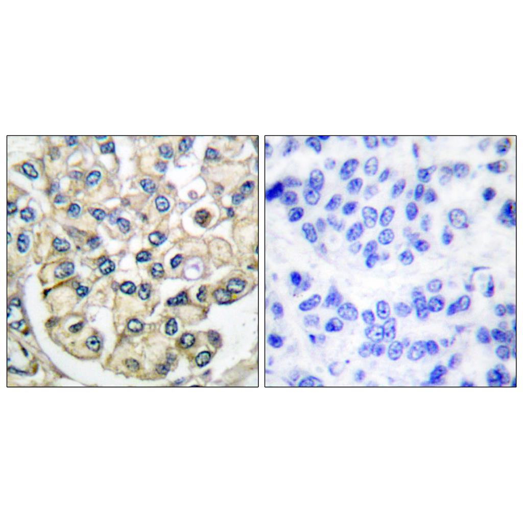 Bek Rabbit Polyclonal Antibody | 兔多抗 | EnkiLife恩玑生命