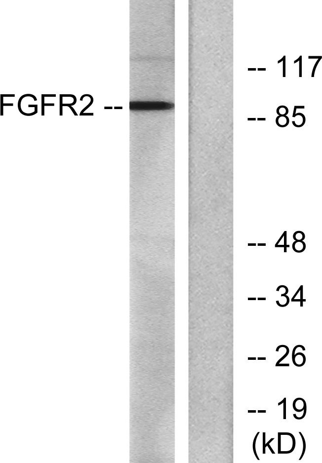 Bek Rabbit Polyclonal Antibody | 兔多抗 | EnkiLife恩玑生命