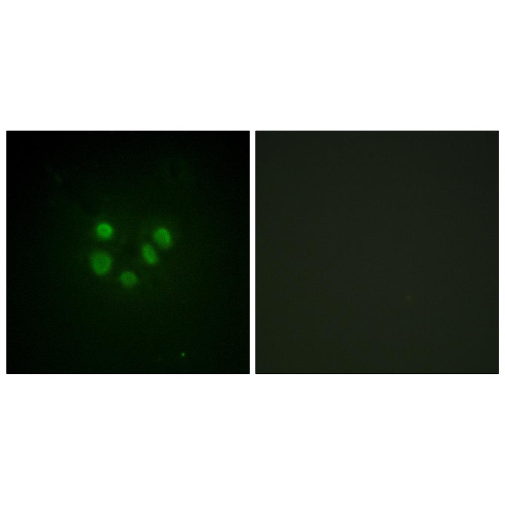 BLM Rabbit Polyclonal Antibody | 兔多抗 | EnkiLife恩玑生命