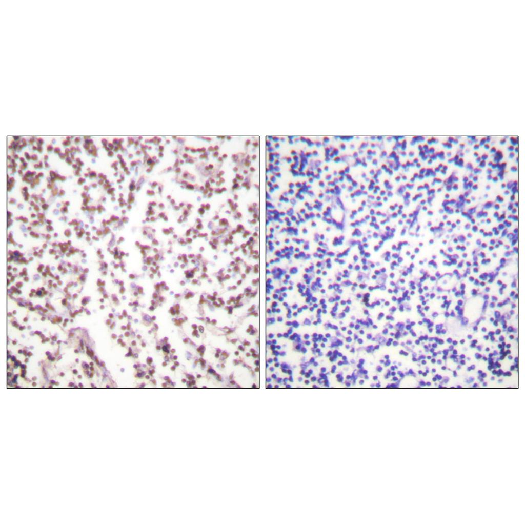 BLM Rabbit Polyclonal Antibody | 兔多抗 | EnkiLife恩玑生命