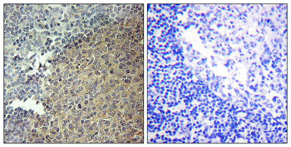 BLNK Rabbit Polyclonal Antibody | 兔多抗 | EnkiLife恩玑生命