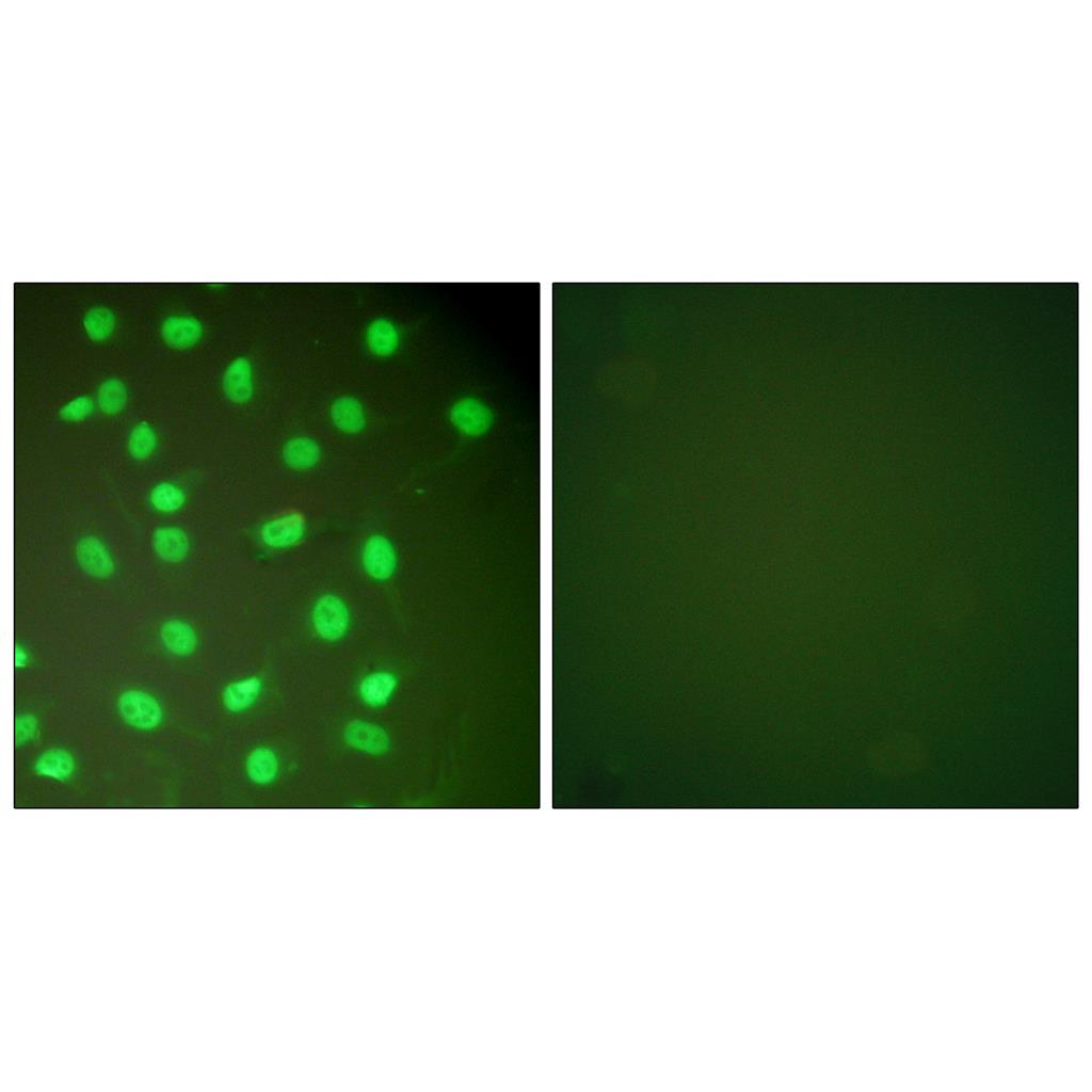 BM28 Rabbit Polyclonal Antibody | 兔多抗 | EnkiLife恩玑生命