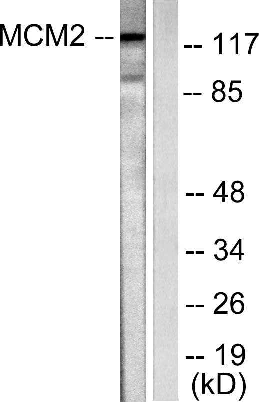 BM28 Rabbit Polyclonal Antibody | 兔多抗 | EnkiLife恩玑生命