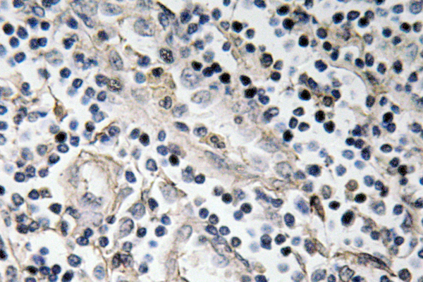 BMP-7 Rabbit Polyclonal Antibody | 兔多抗 | EnkiLife恩玑生命