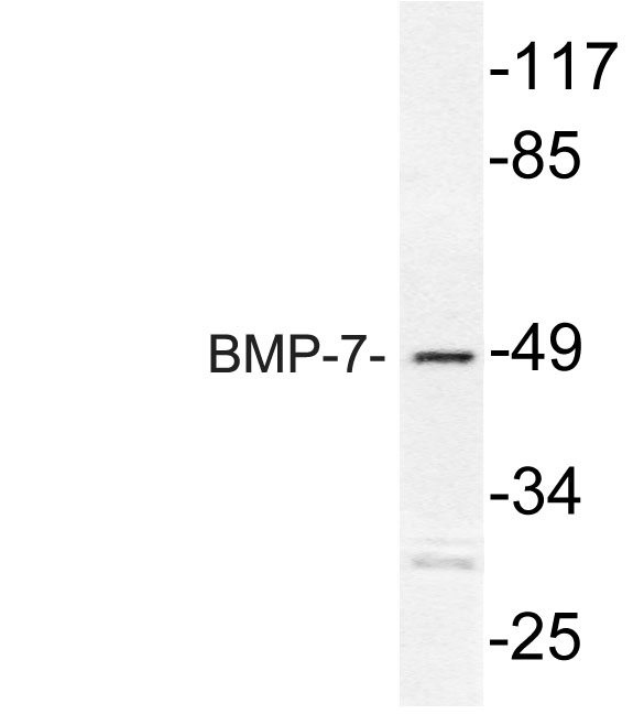 BMP-7 Rabbit Polyclonal Antibody | 兔多抗 | EnkiLife恩玑生命