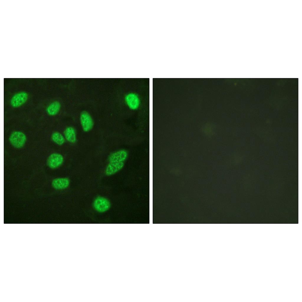 B-Myb Rabbit Polyclonal Antibody | 兔多抗 | EnkiLife恩玑生命