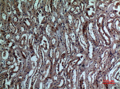 BNIP-3 Rabbit Polyclonal Antibody | 兔多抗 | EnkiLife恩玑生命
