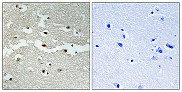 BRCA2 Rabbit Polyclonal Antibody | 兔多抗 | EnkiLife恩玑生命
