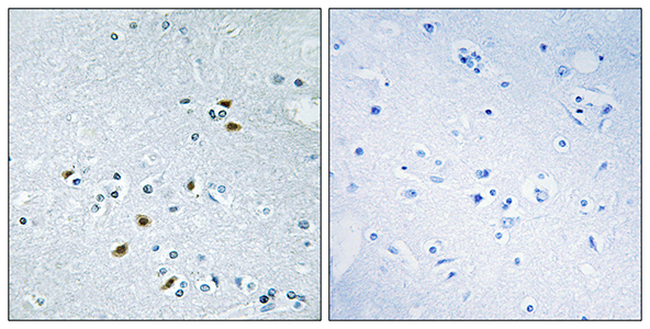 BRCA2 Rabbit Polyclonal Antibody | 兔多抗 | EnkiLife恩玑生命