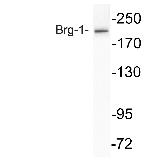 Brg-1 Rabbit Polyclonal Antibody | 兔多抗 | EnkiLife恩玑生命