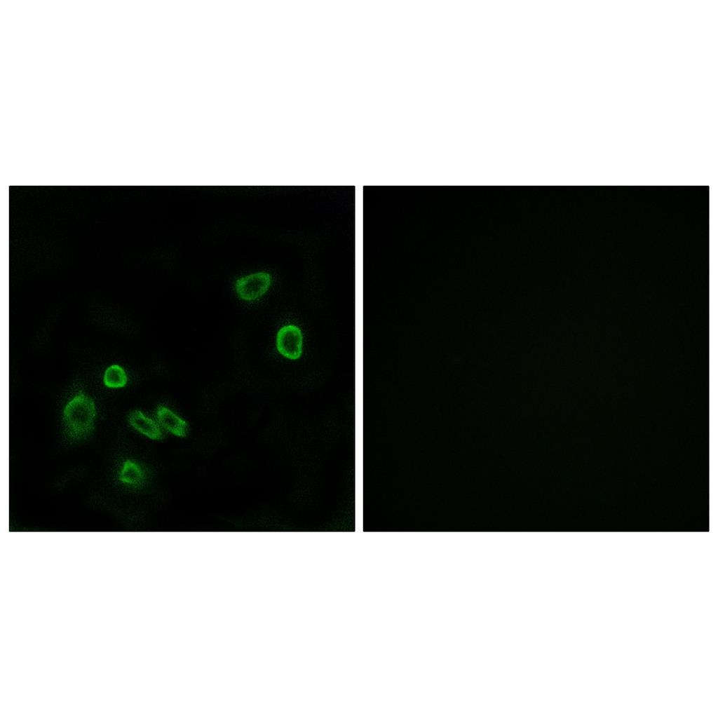Brp44L Rabbit Polyclonal Antibody | 兔多抗 | EnkiLife恩玑生命
