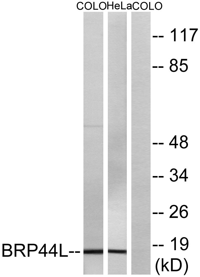 Brp44L Rabbit Polyclonal Antibody | 兔多抗 | EnkiLife恩玑生命