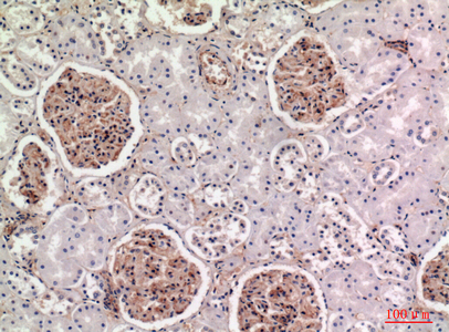 BST-2 Rabbit Polyclonal Antibody | 兔多抗 | EnkiLife恩玑生命