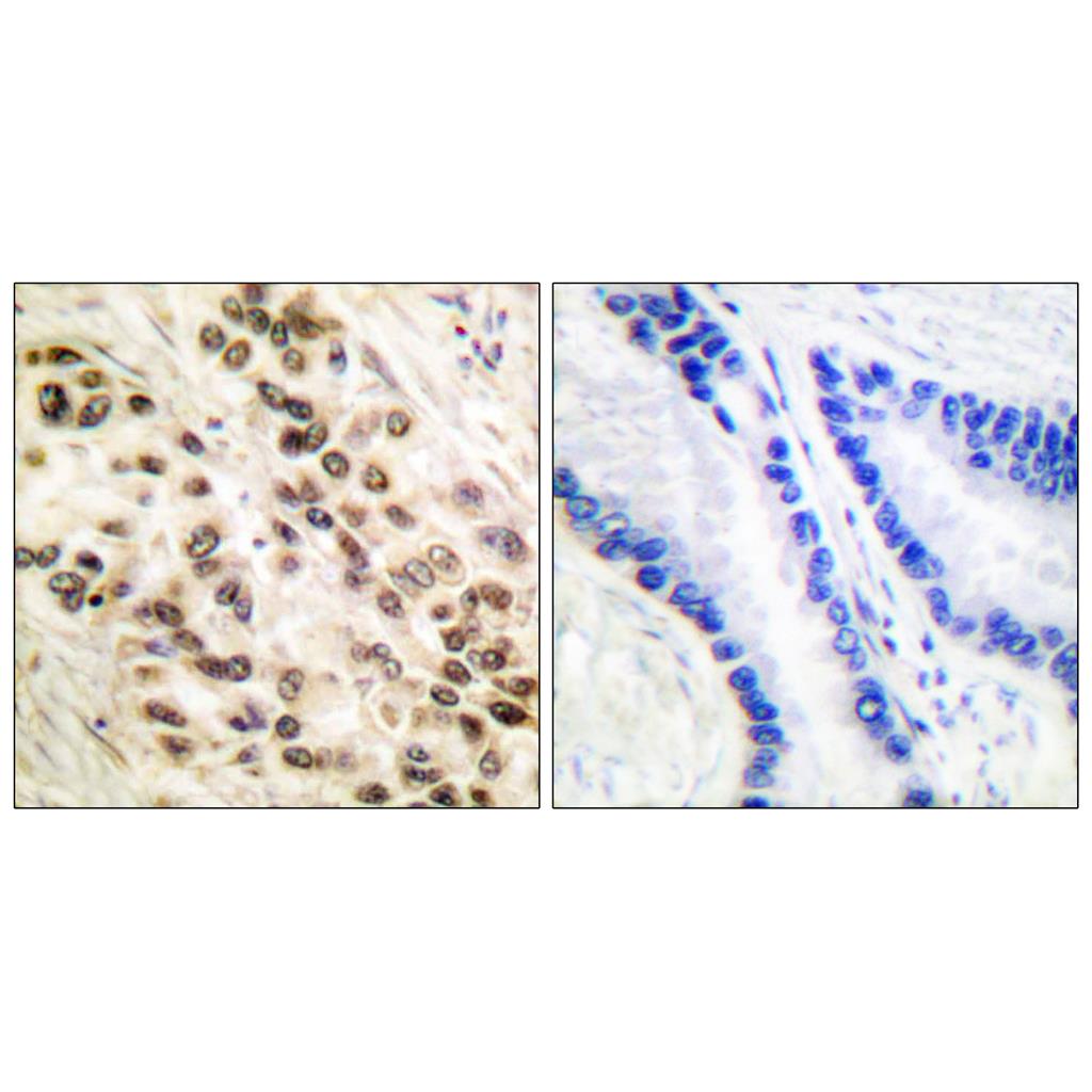 C/EBP β Rabbit Polyclonal Antibody | 兔多抗 | EnkiLife恩玑生命