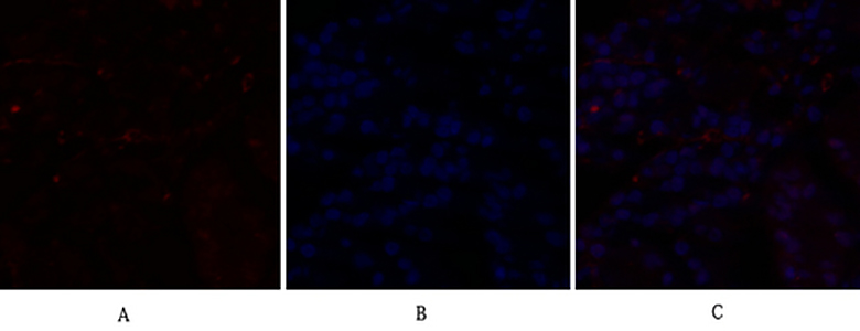 C/EBP β Rabbit Polyclonal Antibody | 兔多抗 | EnkiLife恩玑生命