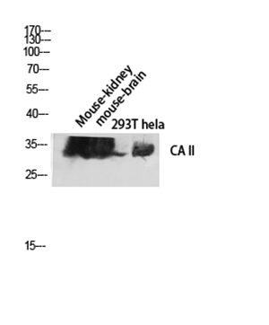 CA II Rabbit Polyclonal Antibody | 兔多抗 | EnkiLife恩玑生命