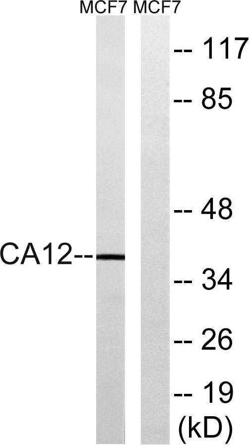 CA XII Rabbit Polyclonal Antibody | 兔多抗 | EnkiLife恩玑生命