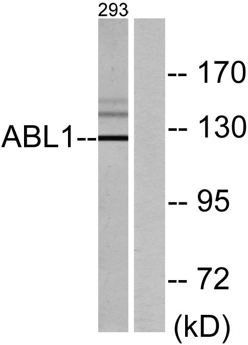 c-Abl Rabbit Polyclonal Antibody | 兔多抗 | EnkiLife恩玑生命