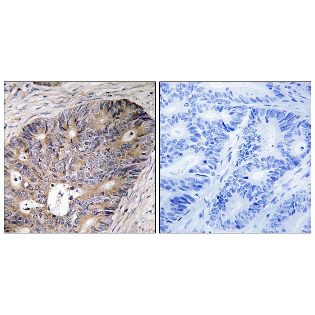 CAD Rabbit Polyclonal Antibody | 兔多抗 | EnkiLife恩玑生命