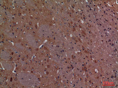 Calbindin D28K Rabbit Polyclonal Antibody | 兔多抗 | EnkiLife恩玑生命