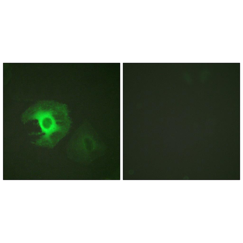 Caldesmon Rabbit Polyclonal Antibody | 兔多抗 | EnkiLife恩玑生命